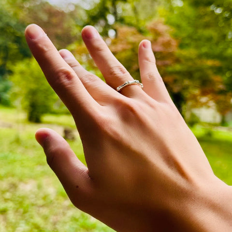 Bone Joint Ring