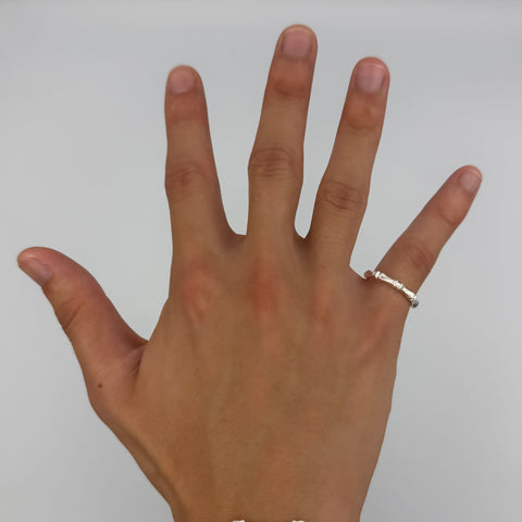 Bone Joint Ring